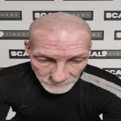 SMP result Kent client Ian - after treatment