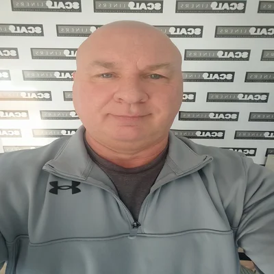 Mark Terrell ScalpLiners owner scalp micropigmentation Whitstable — session 3