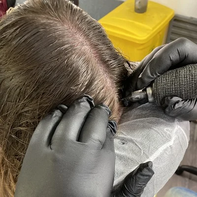 Women's scalp micropigmentation result for thinning hair in Kent