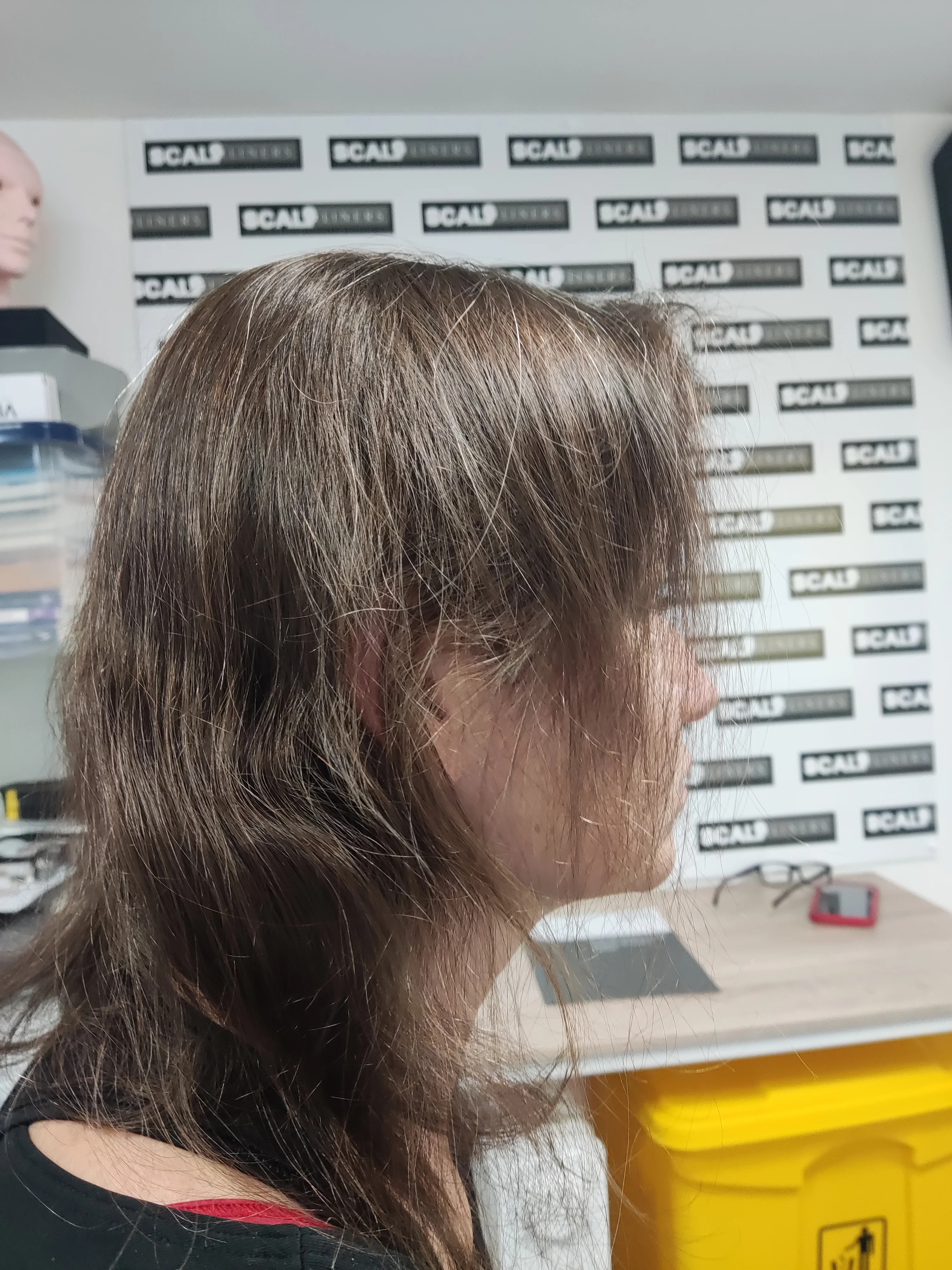 Women's hair loss before SMP — ScalpLiners Kent